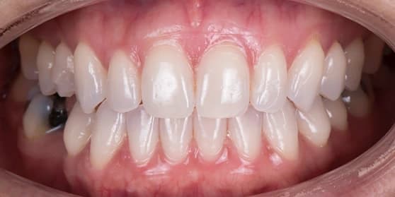 Image of teeth
