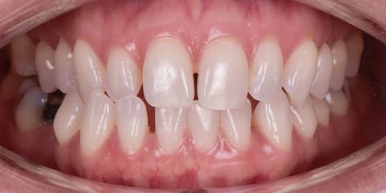 Image of teeth