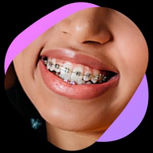 Girl smiling with braces
