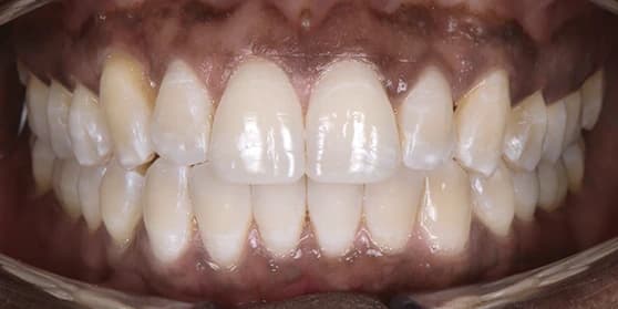 Image of teeth