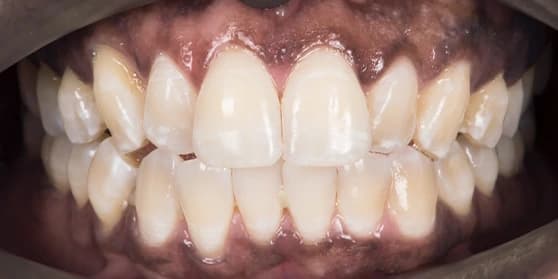 Image of teeth