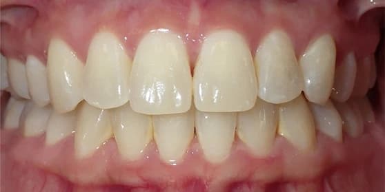 Image of teeth