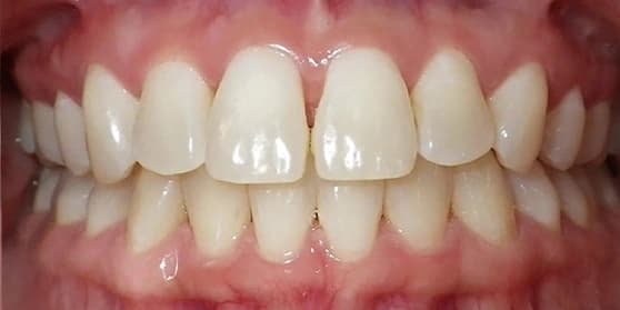 Image of teeth