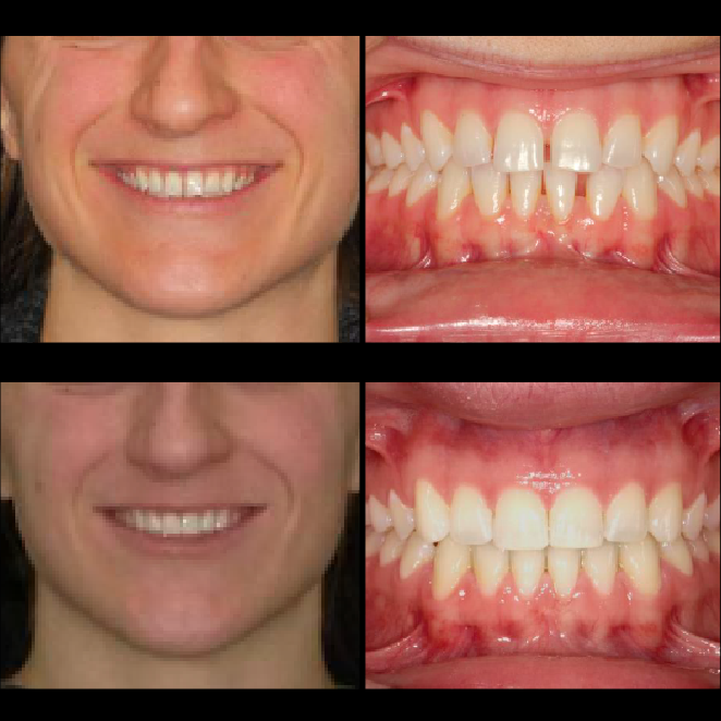 SS Case Study_ Case22_BeforeAfter