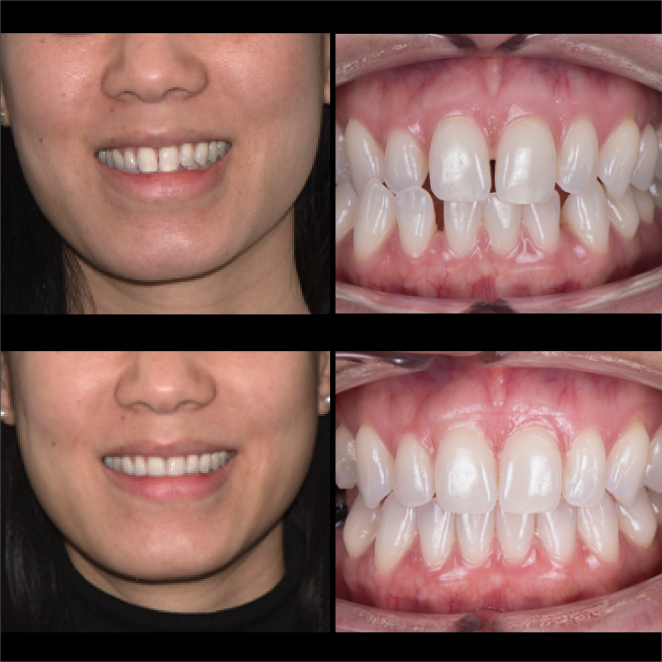 SS Case Study_Case 25_BeforeAfter