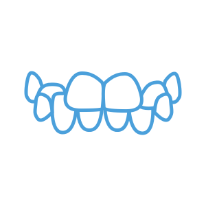 <strong>Crossbite</strong> </br> <p class='formDescription'>Upper teeth bite inside your lower teeth, on one or both sides of your jaw.</p>