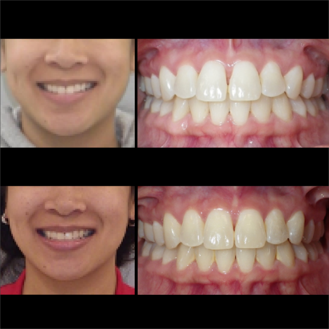 SS Case Study_Case 29_BeforeAfter
