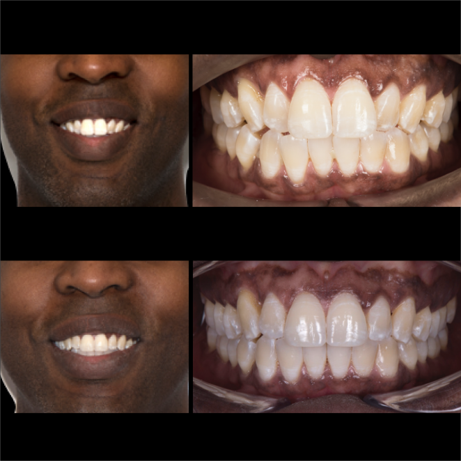 SS Case Study_Case 26_BeforeAfter