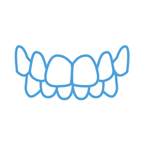 <strong>咬合過深</strong>  </br> <p>咬合時上排牙齒嚴重蓋過下排牙齒</br></br></p>