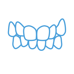 <strong>牙齒擁擠 </strong> </br> <p >因空間不足而造成牙齒歪斜及重疊</br></br></p>